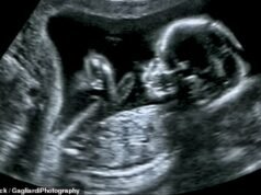 KHADIJA KHAN: Coloro che indossano il cordino temono di essere definiti razzisti. Ecco perché chiudono un occhio sull’aborto selettivo per sesso