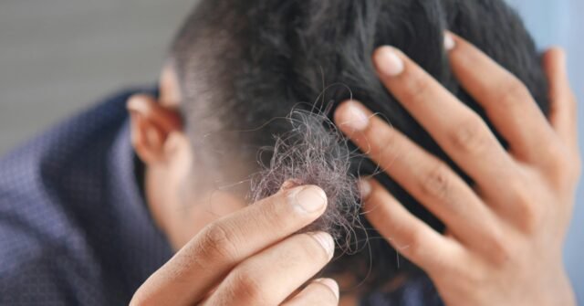 hair-loss-treatment-640x335.jpg