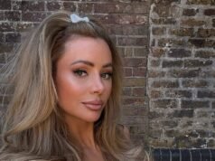 Olivia Attwood dice che si sente come se qualcuno le avesse “rubato la personalità” dopo la straziante separazione dal marito Bradley Dack