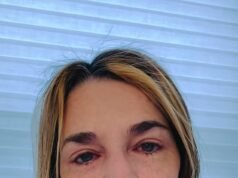 La lacrimosa Savannah Guthrie offre una ricompensa di 1 MILIONE di dollari per la madre rapita Nancy Guthrie, 84 anni, e ammette per la prima volta che potrebbe essere morta