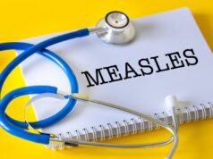 La mappa mostra l’aumento delle epidemie di morbillo negli Stati Uniti