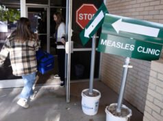 Gli ospedali che combattono il morbillo si trovano ad affrontare una sfida: pochi medici l’hanno mai visto prima