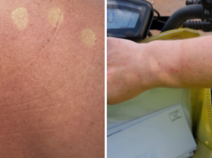 Ai postini è stato detto di smettere di indossare l’uniforme a causa delle notizie secondo cui si sarebbero scottati