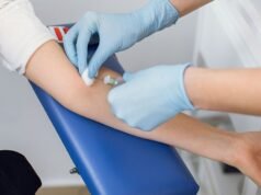 Come un esame del sangue può prevedere se e quando potresti contrarre l’Alzheimer