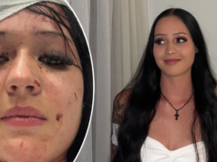 “Che lotta”: aggiornamento della famiglia dopo l’accoltellamento nel club