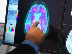 Quasi mezzo milione di australiani vivono con il più grande assassino della nazione