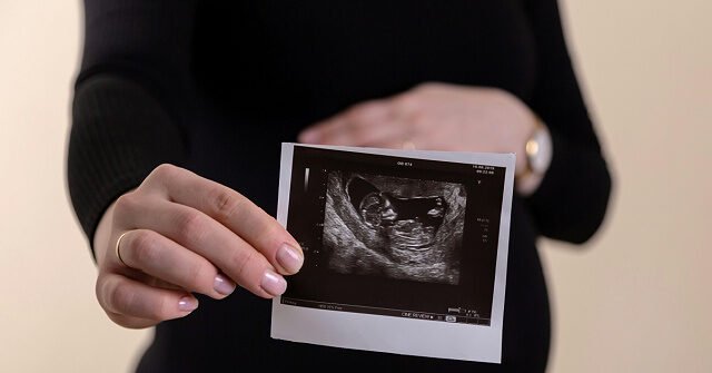 ultrasound-photo-pregnant-woman-baby-volodymyr-hryshchenko-unsplash-640x335.jpg