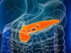 Speranza in una diagnosi precoce del cancro al pancreas man mano che gli scienziati scoprono il “segnale di allarme precoce” di una malattia mortale