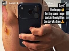 Il ciclista campione pubblica una foto nuda per rivelare le cicatrici del brutale incidente che lo ha visto scontrarsi con un cartello stradale e un ciclista rivale