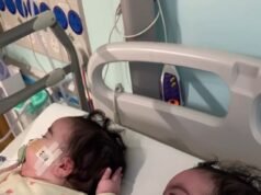 Jesy Nelson rivela che le loro figlie gemelle, di 9 mesi, sono in cura al Great Ormond Street Hospital mentre condivide la foto straziante delle loro stecche per gamba abbinate durante il trattamento in corso per la SMA