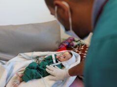 La fame incombe sullo Yemen, sono necessari interventi urgenti