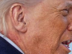 Che cavolo c’è che non va con il collo di Trump?