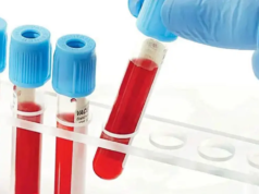 Il 78% della popolazione urbana è esposta a residui di pesticidi e tossine: indagine