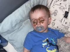 Una mamma che controlla il bambino di notte nota strani segni sugli occhi e poi se ne rende conto