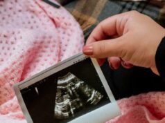 Il gruppo giovanile ha ospitato corsi di formazione “Doula sull’aborto” per quattordicenni