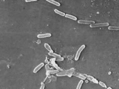 Un prodotto improbabile in milioni di garage australiani potrebbe alimentare i superbatteri