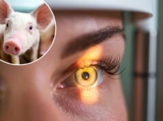 C’è una nuova scoperta nel trattamento del cancro agli occhi: grazie allo sperma di maiale