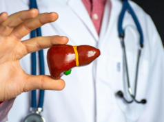L’epatite A può scatenare insufficienza epatica acuta nelle persone con fegato grasso: medici