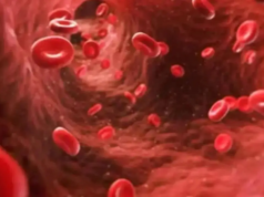 Giornata mondiale dell’emofilia: perché le donne affette da emofilia continuano a ricevere diagnosi errate