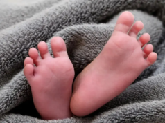 Medici di Mumbai rimuovono un tumore al cervello grande quanto una pallina da tennis in un bambino di tre mesi