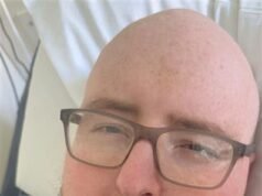 Un uomo, 43 anni, pensava che i crampi allo stomaco fossero causati da “calcoli biliari” senza sapere che erano sintomi di cancro al pancreas… morì otto mesi dopo