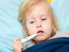 Non darlo per scontato! Questi sono sintomi del morbillo nei bambini che possono essere fatali