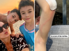 Mio figlio si è sbucciato il braccio. Ho quasi mancato il segnale di avvertimento che era in pericolo di vita