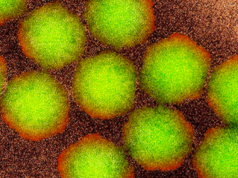 Rilevata una malattia contagiosa che non si vedeva in Australia da oltre 50 anni