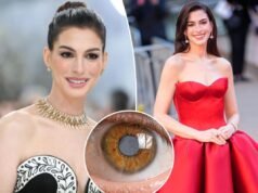 Le condizioni mediche segrete decennali di Anne Hathaway l’hanno lasciata quasi cieca durante i suoi 30 anni
