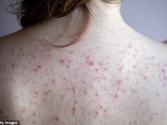 Guida dermatologica alla acne: quali sono le cause delle macchie antiestetiche e dolorose sulla schiena e come eliminarle… velocemente