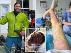 Papà sopravvive al coma di cinque settimane dopo l’esplosione della “palla di fuoco” mentre preparava il gin