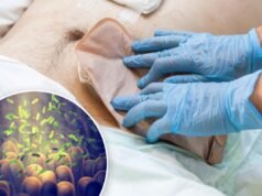Una nuova scoperta sul cancro del colon-retto potrebbe portare a una diagnosi più precoce