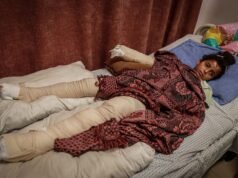 “Tra dolore e paura”: i bambini di Gaza sopportano il costo degli attacchi israeliani in corso