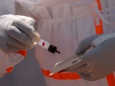 Il rischio di Ebola per la Coppa del Mondo è “estremamente basso”, ma gli Stati Uniti sono pronti, dicono gli esperti