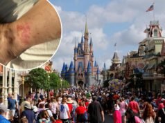 Che cos’è l'”eruzione cutanea Disney”? Il problema chiazzato, gonfio e pruriginoso colpisce con maggiore probabilità le persone sopra i 50 anni