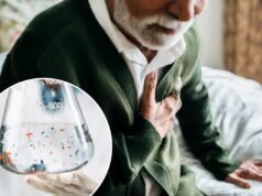 Microplastiche trovate nel sangue della maggior parte delle vittime di infarto, rivela uno studio bomba