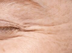 È vero che la pelle inizia a invecchiare a 25 anni? Riconosci questi segnali