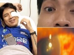 In pochi secondi, l’occhio di Desta sanguina a causa della palla da paddle, era ‘temporaneamente cieco’ finché non è stato portato d’urgenza in ospedale