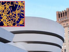 Batteri della malattia dei legionari rilevati negli edifici di Manhattan