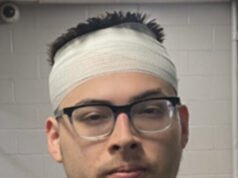 Ragazze adolescenti picchiano un tossicodipendente armato di coltello nel Connecticut