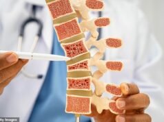 Il governo è stato criticato per non aver implementato cliniche di screening per l’osteoporosi in Inghilterra – dopo che è emerso che NHS Wales lo ha fatto con ‘investimenti relativamente bassi’