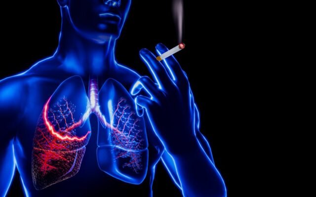 Il rischio di morte per fumo sembra essere in aumento: uno studio trova una ragione sorprendente Il rischio di morte per fumo sembra essere in aumento: uno studio trova una ragione sorprendente