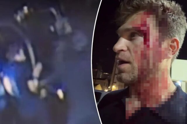 La star di ‘Pretty Little Liars’, Keegan Allen, derubata sotto la minaccia di armi da fuoco e coltello in un attacco fuori da un lussuoso negozio di alimentari di Hollywood La star di ‘Pretty Little Liars’, Keegan Allen, derubata sotto la minaccia di armi da fuoco e coltello in un attacco fuori da un lussuoso negozio di alimentari di Hollywood
